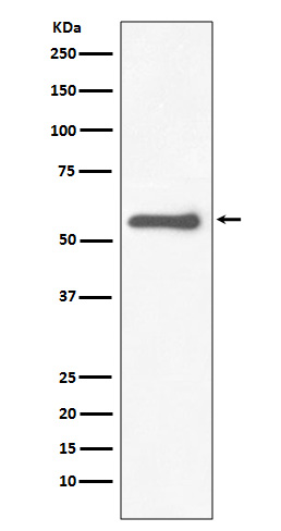 1 - Anti-Tyrosine Hydroxylase TH Rabbit Monoclonal Antibody ABO14276