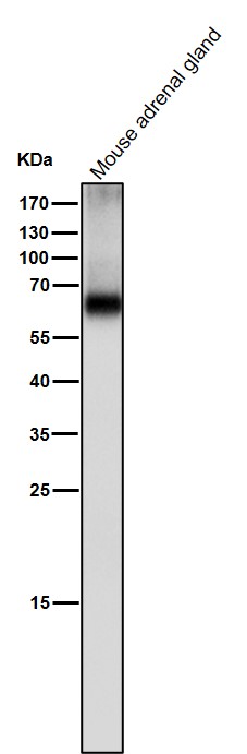 1 - Anti-Tyrosine Hydroxylase TH Rabbit Monoclonal Antibody ABO14276