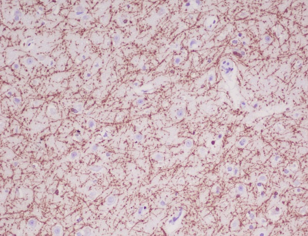 2 - Anti-Myelin Basic Protein MBP Rabbit Monoclonal Antibody ABO14277