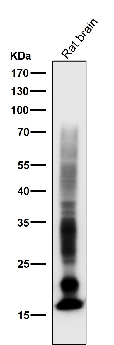 1 - Anti-Myelin Basic Protein MBP Rabbit Monoclonal Antibody ABO14277