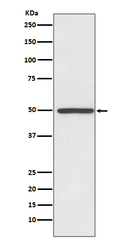 1 - Anti-Dopamine Transporter SLC6A3 Rabbit Monoclonal Antibody ABO14279