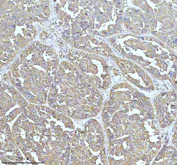 2 - Anti-Clathrin heavy chain Rabbit Monoclonal Antibody ABO14280