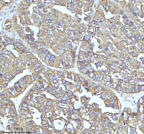 2 - Anti-Clathrin heavy chain Rabbit Monoclonal Antibody ABO14280