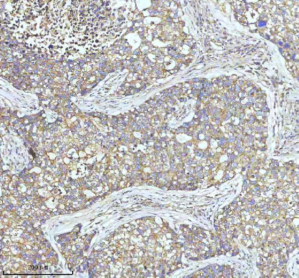 2 - Anti-Clathrin heavy chain Rabbit Monoclonal Antibody ABO14280