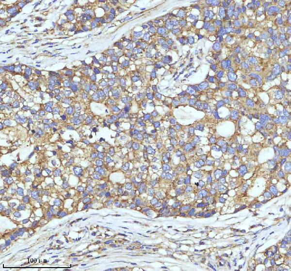 2 - Anti-Clathrin heavy chain Rabbit Monoclonal Antibody ABO14280