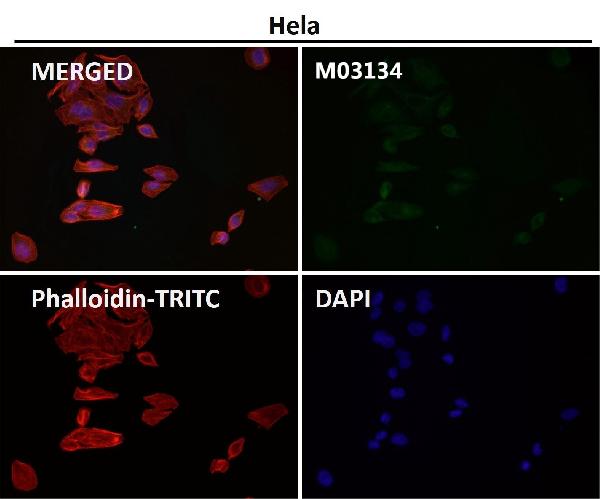 1 - Anti-Clathrin heavy chain Rabbit Monoclonal Antibody ABO14280