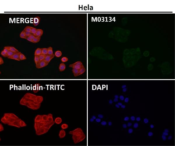 1 - Anti-Clathrin heavy chain Rabbit Monoclonal Antibody ABO14280
