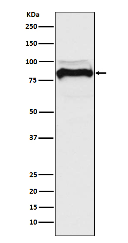 1 - Anti-TGF beta Receptor II TGFBR2 Rabbit Monoclonal Antibody ABO14281