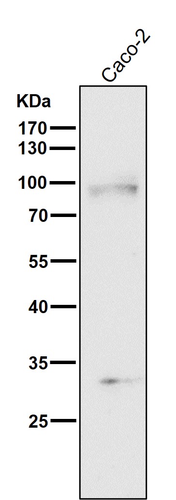 1 - Anti-TGF beta Receptor II TGFBR2 Rabbit Monoclonal Antibody ABO14281
