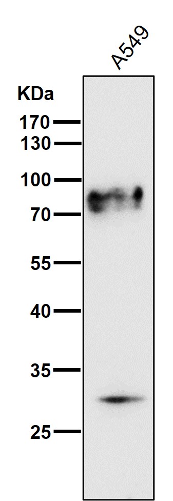 1 - Anti-TGF beta Receptor II TGFBR2 Rabbit Monoclonal Antibody ABO14281