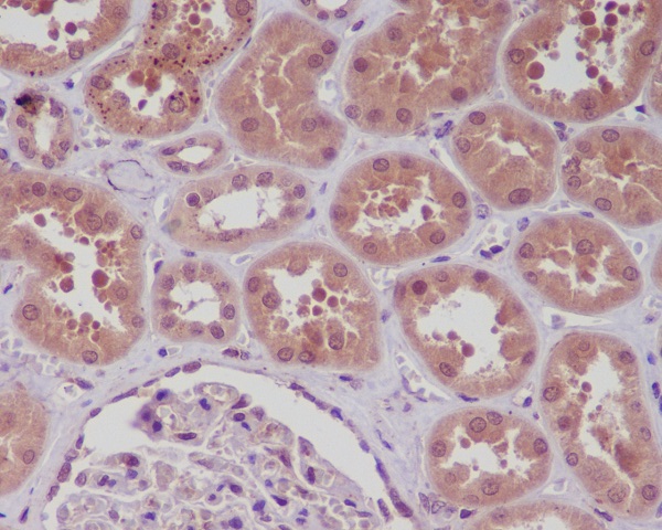 2 - Anti-NF-Kappa B (p105/p50) NFKB1 Rabbit Monoclonal Antibody ABO14282