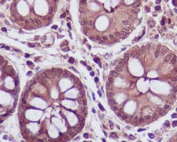 2 - Anti-Lactate Dehydrogenase LDHA Rabbit Monoclonal Antibody ABO14283