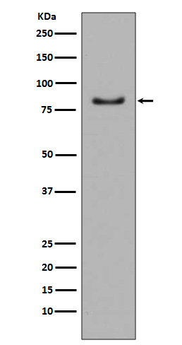 1 - Anti-PI 3 Kinase p85 alpha PIK3R1 Rabbit Monoclonal Antibody ABO14284