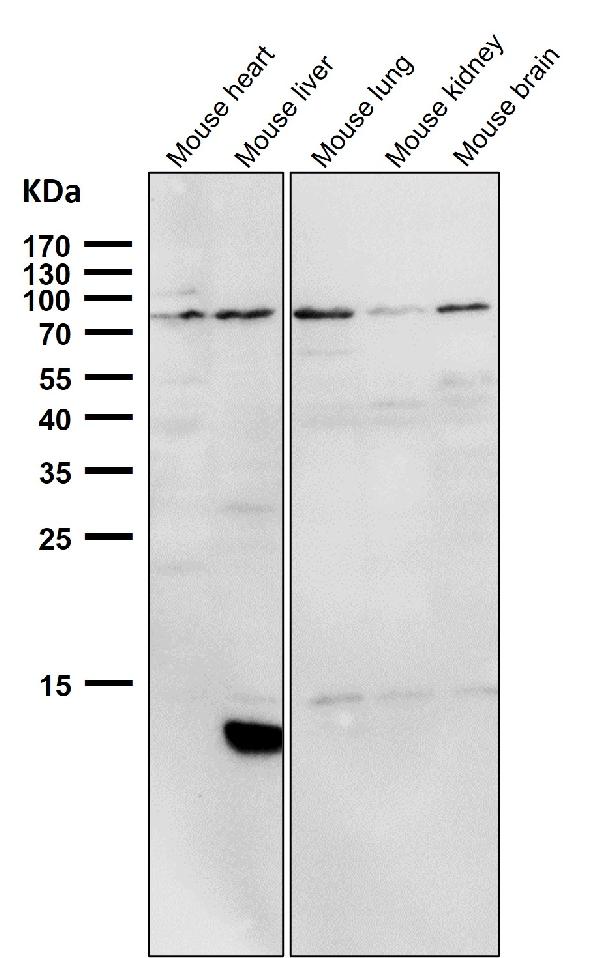1 - Anti-PI 3 Kinase p85 alpha PIK3R1 Rabbit Monoclonal Antibody ABO14284