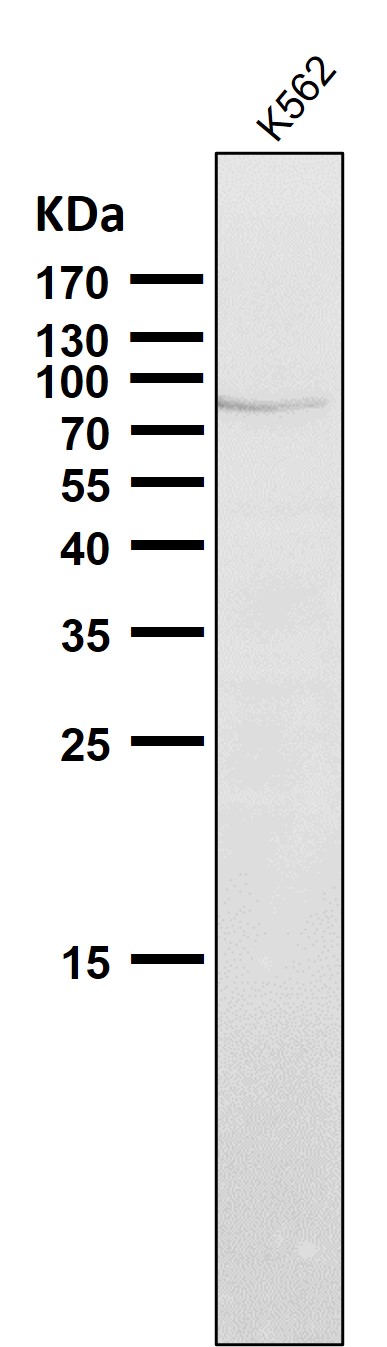 1 - Anti-PI 3 Kinase p85 alpha PIK3R1 Rabbit Monoclonal Antibody ABO14284
