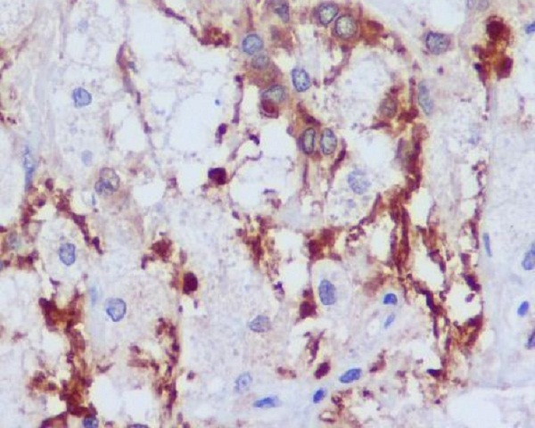 2 - Anti-PI 3 Kinase p55 gamma PIK3R3 Rabbit Monoclonal Antibody ABO14285