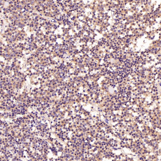 2 - Anti-PI 3 Kinase p55 gamma PIK3R3 Rabbit Monoclonal Antibody ABO14285