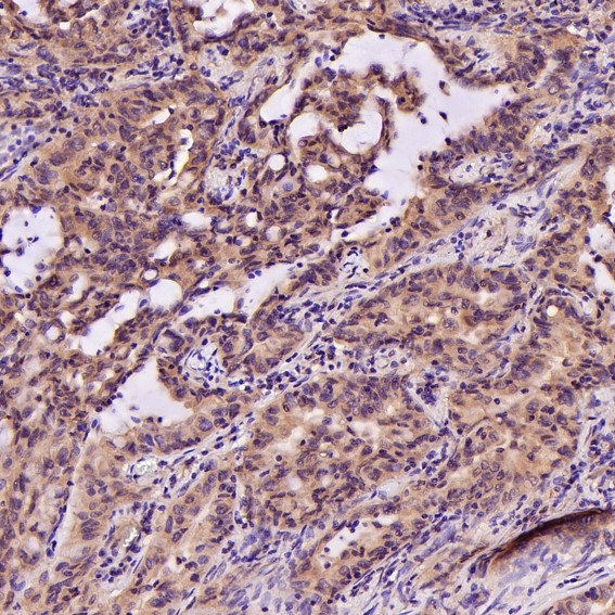 2 - Anti-PI 3 Kinase p55 gamma PIK3R3 Rabbit Monoclonal Antibody ABO14285