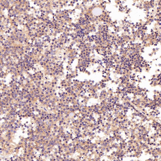 2 - Anti-PI 3 Kinase p55 gamma PIK3R3 Rabbit Monoclonal Antibody ABO14285