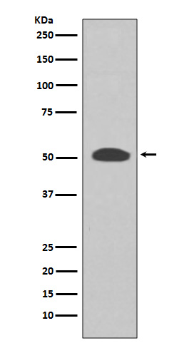 1 - Anti-PI 3 Kinase p55 gamma PIK3R3 Rabbit Monoclonal Antibody ABO14285