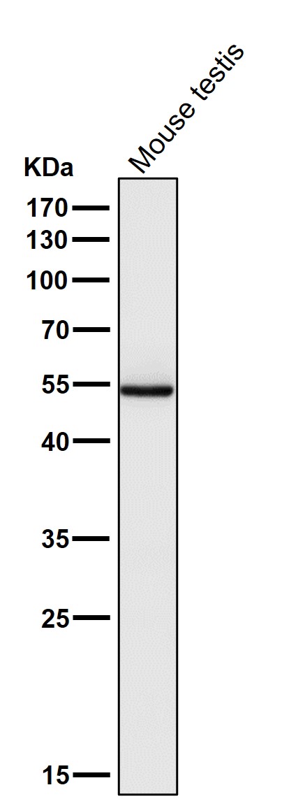 1 - Anti-PI 3 Kinase p55 gamma PIK3R3 Rabbit Monoclonal Antibody ABO14285