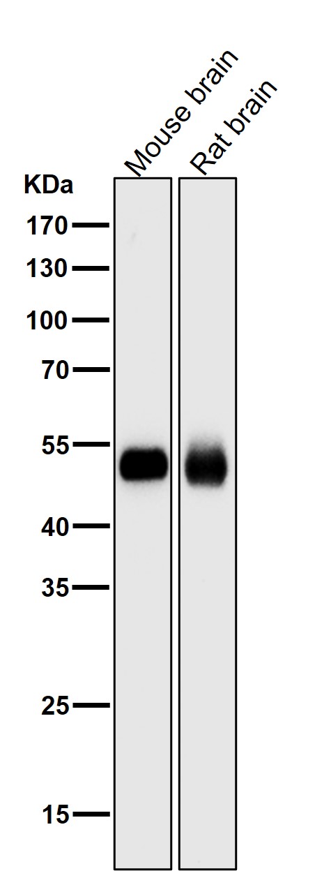 1 - Anti-PI 3 Kinase p55 gamma PIK3R3 Rabbit Monoclonal Antibody ABO14285