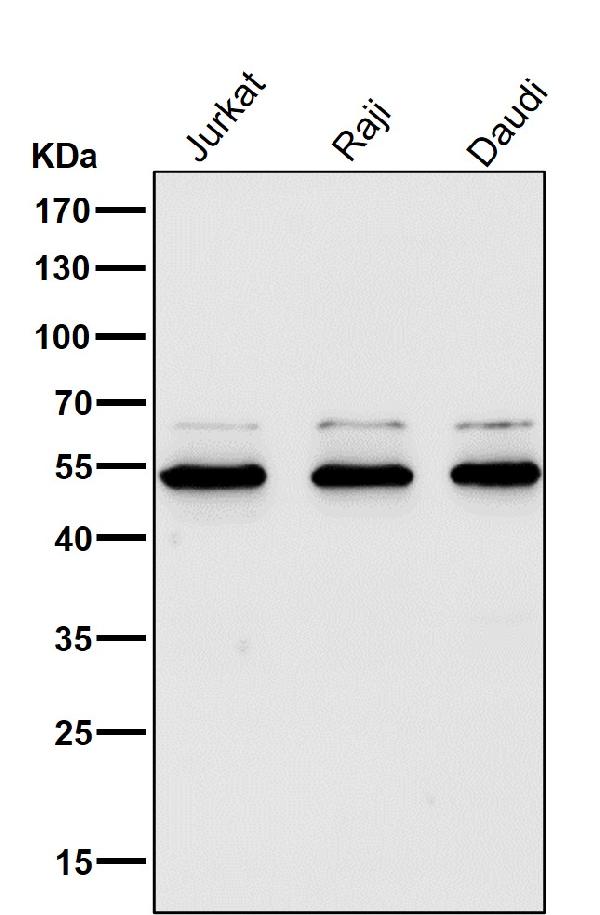 1 - Anti-PI 3 Kinase p55 gamma PIK3R3 Rabbit Monoclonal Antibody ABO14285