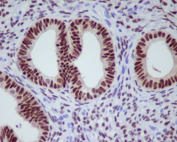 2 - Anti-Progesterone Receptor PGR Rabbit Monoclonal Antibody ABO14286