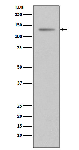 1 - Anti-Progesterone Receptor PGR Rabbit Monoclonal Antibody ABO14286