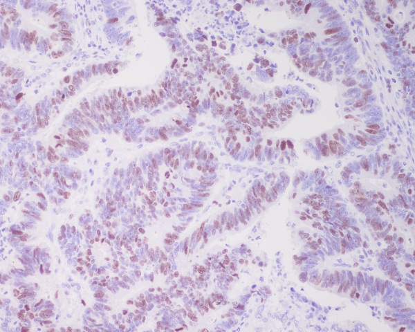 2 - Anti-Topoisomerase II alpha TOP2A Rabbit Monoclonal Antibody ABO14288
