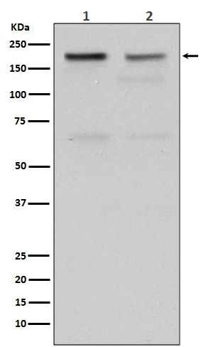 1 - Anti-Topoisomerase II alpha TOP2A Rabbit Monoclonal Antibody ABO14288