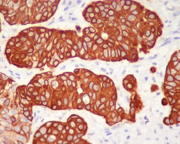 2 - Anti-Cytokeratin 5 (C-term) KRT5 Rabbit Monoclonal Antibody ABO14289