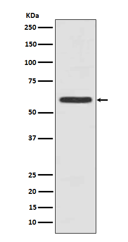 1 - Anti-Cytokeratin 5 (C-term) KRT5 Rabbit Monoclonal Antibody ABO14289