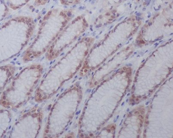 2 - Anti-active + pro Caspase 3 CASP3 Rabbit Monoclonal Antibody ABO14291