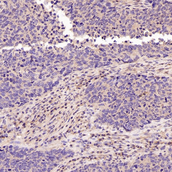 2 - Anti-active + pro Caspase 3 CASP3 Rabbit Monoclonal Antibody ABO14291