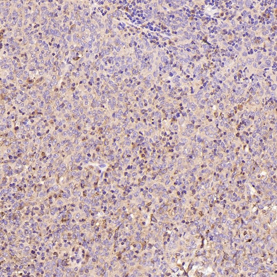 2 - Anti-active + pro Caspase 3 CASP3 Rabbit Monoclonal Antibody ABO14291