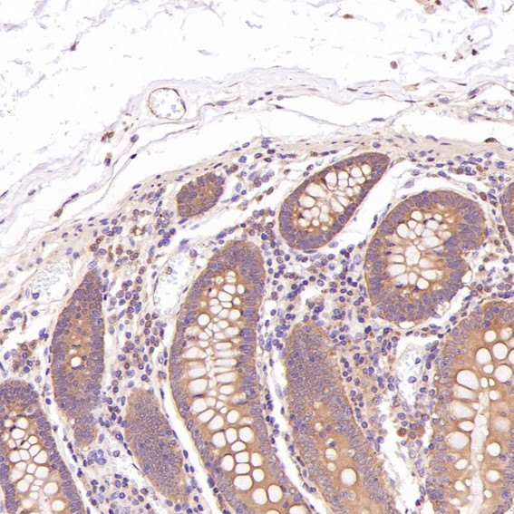 2 - Anti-active + pro Caspase 3 CASP3 Rabbit Monoclonal Antibody ABO14291