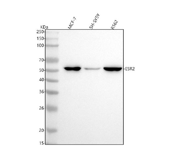 1 - Anti-Estrogen Receptor beta ESR2 Rabbit Monoclonal Antibody ABO14293