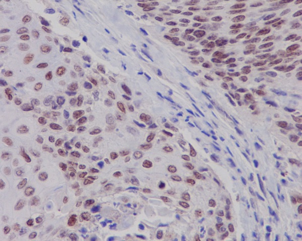 2 - Anti-Estrogen Receptor beta ESR2 Rabbit Monoclonal Antibody ABO14293