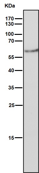 1 - Anti-Estrogen Receptor beta ESR2 Rabbit Monoclonal Antibody ABO14293
