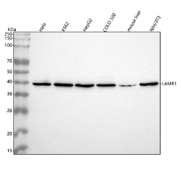 1 - Anti-67kDa Laminin Receptor RPSA Rabbit Monoclonal Antibody ABO14294