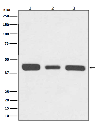 1 - Anti-67kDa Laminin Receptor RPSA Rabbit Monoclonal Antibody ABO14294