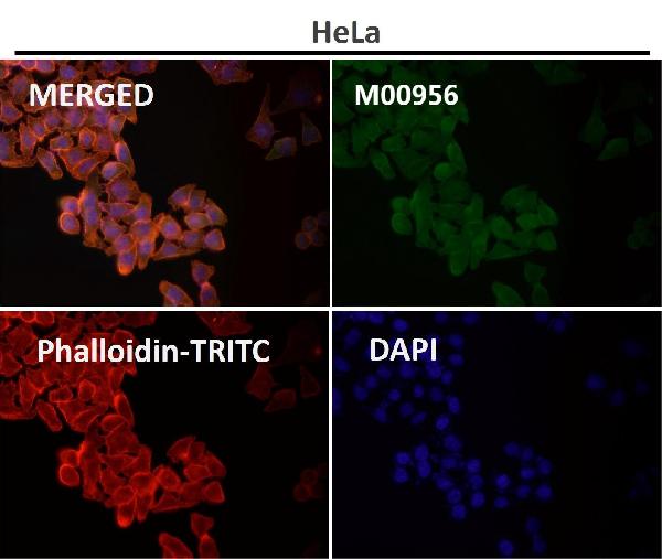 1 - Anti-Sodium Potassium ATPase ATP1A1 Rabbit Monoclonal Antibody ABO14296