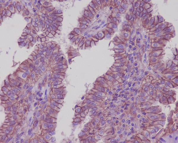 2 - Anti-Sodium Potassium ATPase ATP1A1 Rabbit Monoclonal Antibody ABO14296