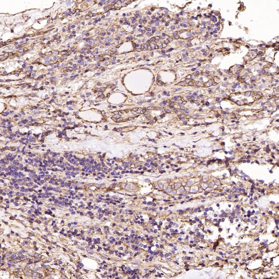 2 - Anti-Sodium Potassium ATPase ATP1A1 Rabbit Monoclonal Antibody ABO14296
