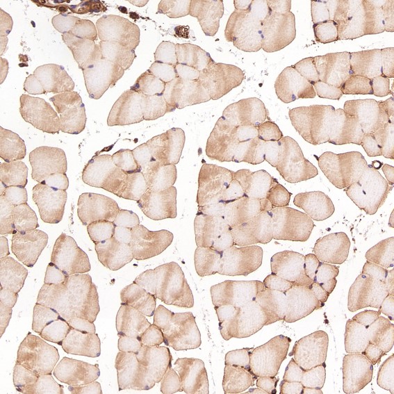 2 - Anti-Sodium Potassium ATPase ATP1A1 Rabbit Monoclonal Antibody ABO14296