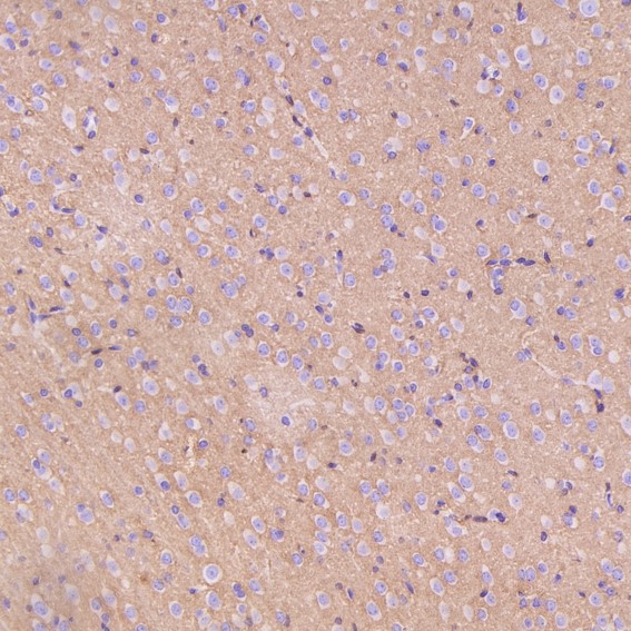 2 - Anti-Sodium Potassium ATPase ATP1A1 Rabbit Monoclonal Antibody ABO14296