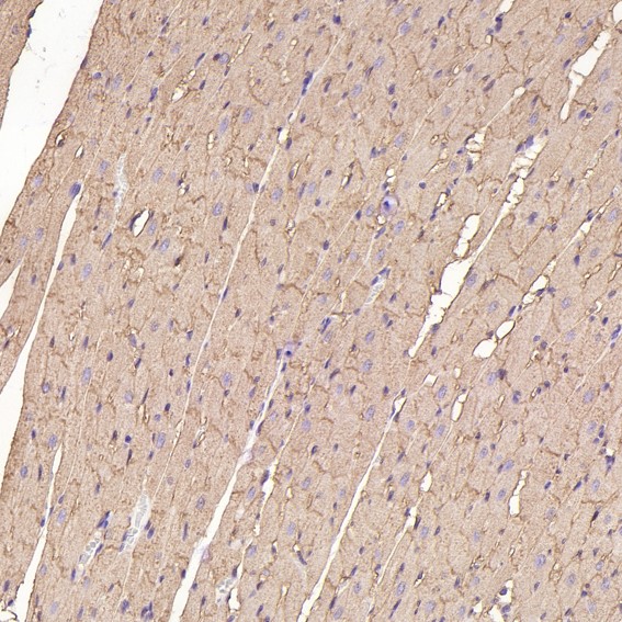 2 - Anti-Sodium Potassium ATPase ATP1A1 Rabbit Monoclonal Antibody ABO14296