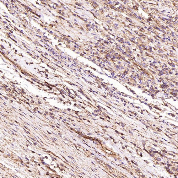 2 - Anti-Sodium Potassium ATPase ATP1A1 Rabbit Monoclonal Antibody ABO14296