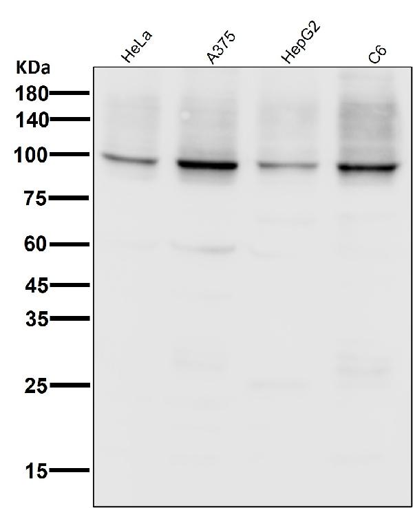 1 - Anti-Sodium Potassium ATPase ATP1A1 Rabbit Monoclonal Antibody ABO14296